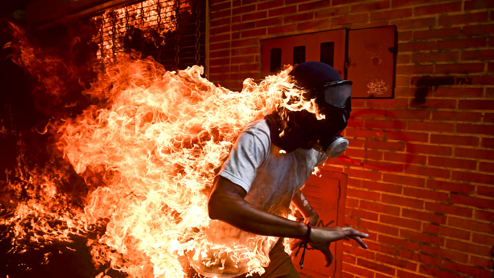 1_Ronaldo Schemidt_Venezuela Crisis_Agence France Presse-3
